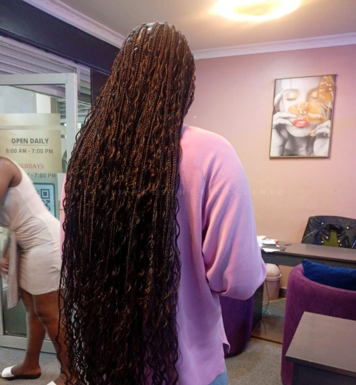 Braids