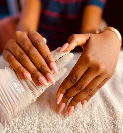 Gel nails